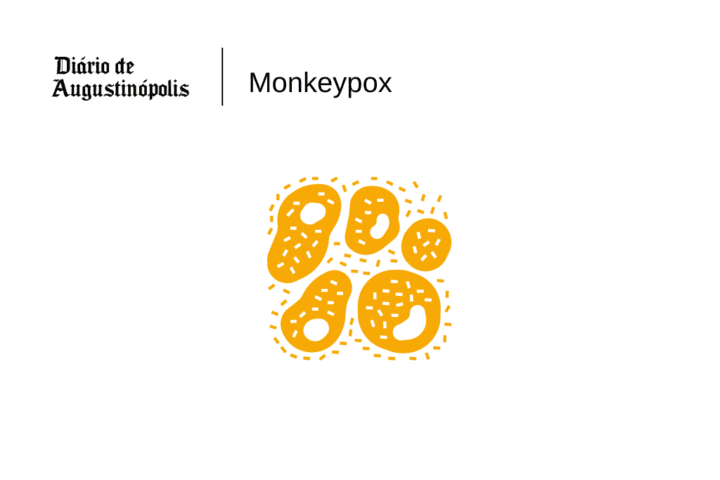 Monkeypox