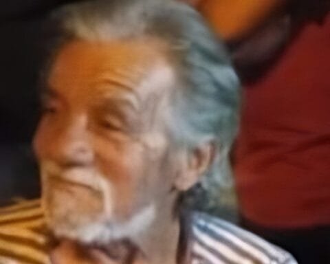 Raimundo vitima queimadura sao sebastiao 232x300 transformed