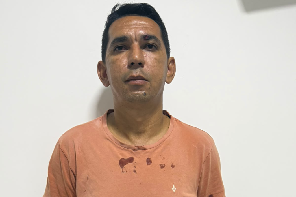 Antônio Eldes Motorista de Ambulancia agredido em Buriti do Tocantins