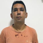 Antônio Eldes Motorista de Ambulancia agredido em Buriti do Tocantins